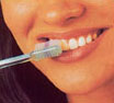 gründliche Zahnreinigung